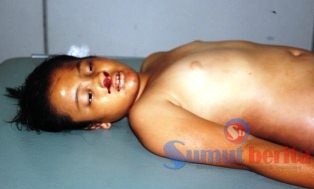 Jasad Stepani di ruang IGD RSU Kabanjahe. SUMUT BERITA | BARON PURBA