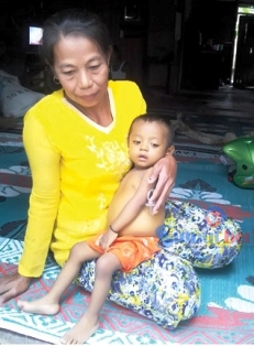 Denis Syahputra (1) Warga Dusun Bunga Tanjung, Desa Dahari Indah, Kecamatan Talawi, Kabupaten Batubara, butuh uluran tangan dan perhatian Pemerintah Kabupaten Batubara. 
